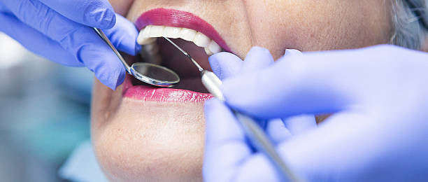 Best Walk-In Emergency Dentist in Newberg, OR